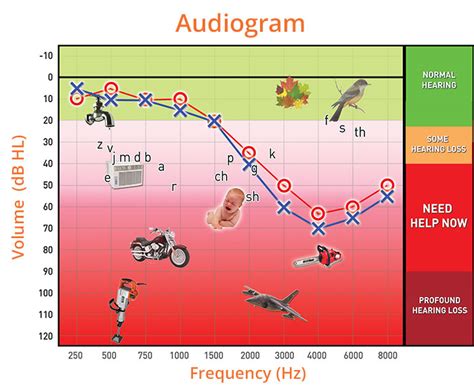 Audiograms: What they are, how to interpret them, and more.